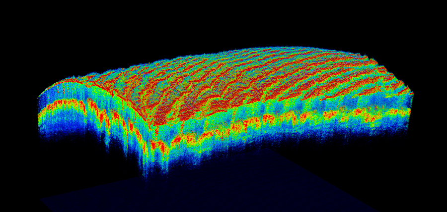 optical coherence tomography คือ test